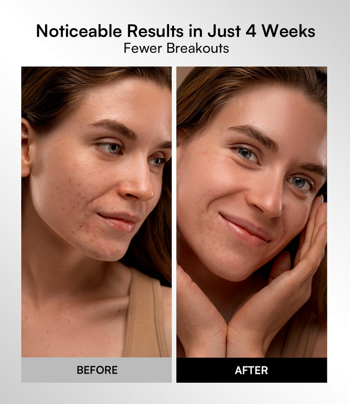 Radiance Red Light Therapy Mask