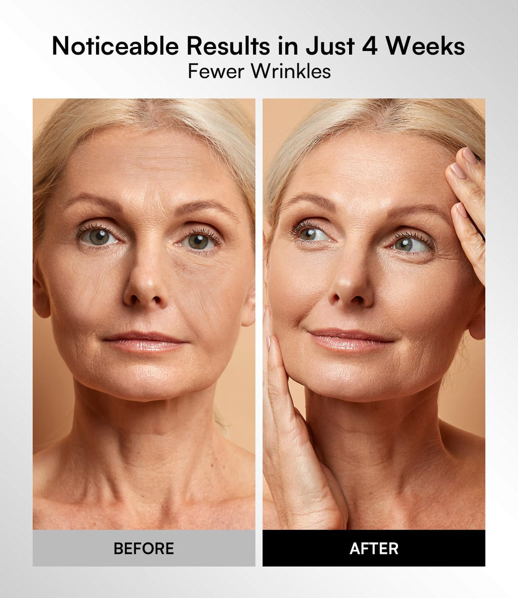 Radiance Red Light Therapy Mask