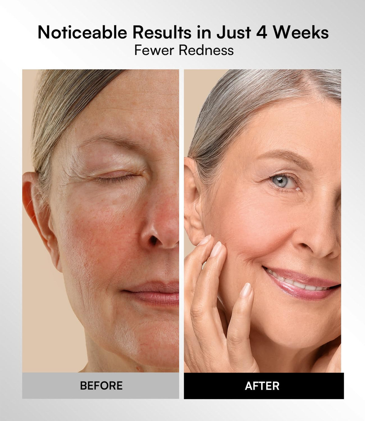 Radiance Red Light Therapy Mask